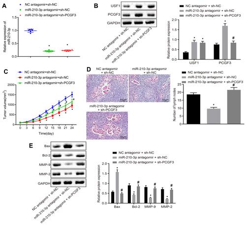 Figure 6 miR-210-3p delays the development and metastasis of lung cancer in vivo by inhibiting PCGF3. (A) Real-time qPCR examined the expression of miR-210-3p in tissues of lung cancer xenografts in mice with intravenous injection of miR-210-3p antagomir alone or with sh-PCGF3. (B) Immunoblots and quantification of USF1 and PCGF3 in tissues of lung cancer xenografts in mice with intravenous injection of miR-210-3p antagomir alone or with sh-PCGF3. (C) Growth of lung cancer xenografts in mice with intravenous injection of miR-210-3p antagomir alone or with sh-PCGF3 was monitored every 3 days after implantation duration of 8 days. (D) Histopathological changes (×200) of lung tissues and lymph node metastasis in xenograft mice with intravenous injection of miR-210-3p antagomir alone or with sh-PCGF3. (E) Immunoblots and quantification of Bax, Bcl-2, MMP-2, and MMP-9 in tissues of lung cancer xenografts in mice with intravenous injection of miR-210-3p antagomir alone or with sh-PCGF3. *p < 0.05 compared to NC antagomir + sh-NC and #p < 0.05 compared to miR-210-3p antagomir + sh-NC by ANOVA adjusted by Tukey’s test or by repeated measurements ANOVA adjusted by Bonferroni test (only for C). Sample size of six mice in each study group.