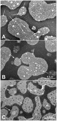 Figure 4. Transmission electron photomicrographs of the Hepes nanoemulsion samples. Panel A: A2; Panel B: B2; Panel C: C2. Arrows indicate NE sizes corresponding to DLS measures.