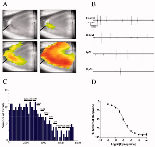 Figure 1. EPI reduces epileptiform burst discharge frequency. (A) Generation of hippocampal CA3 activity. Illustrated are pseudo-color images of a single epileptiform burst generated by voltage sensitive dye. (B) Continuous 150 s-long chart recordings of burst discharges are visualized on Axoscope 9.2. Increasing EPI produced a dose-dependent reduction of epileptiform burst activities. (C) Frequency histogram of burst discharges versus time of EPI administration. Each bin represents a 150-s time interval. (D) Concentration–response curve derived from 52 experiments.
