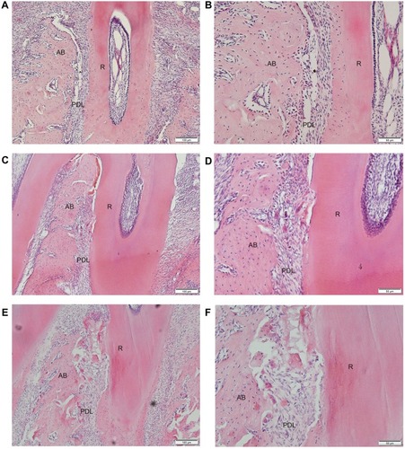 Figure 6 Histologic observation of the compression side of distopalatal root of the maxillary first molar (H&E staining).