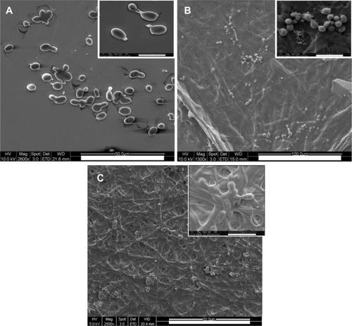 Figure 7 Morphology of Candida albicans grown on polyene-loaded fiber mats. Scanning electron micrographs of C. albicans treated with (A) gelatin fiber mats without antifungals; (B) amphotericin B-loaded fiber mats; and (C) natamycin-loaded fiber mats.Note: Inset scale bar =10 μm.