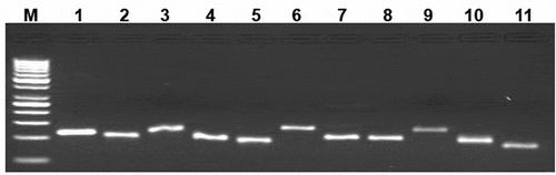 Figure 3. Expression of the BMP/SMAD family of genes in sheep granulosa cells by reverse transcription-polymerase chain reaction (RT-PCR). Representative agarose gel photograph showing the amplification of BMP factors/receptors and SMAD signaling genes. M: 50bp DNA ladder (Fermentas), Lane 1: RPL19, Lane 2: SMAD1, Lane 3: SMAD 3, Lane 4: SMAD 4, Lane 5: SMAD 5, Lane 6: SMAD 8, Lane 7: ACVR2, Lane 8: CYP11A1, Lane 9: AMH, Lane 10: BMPR1B, Lane 11: BMP15.