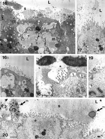 Figures 16–20 Apical region of cholecystocytes coated with pedunculated microvilli (p) and filled with isolated lipid (I), Iysosomal bodies (ly), large, poorly contrasted mucous vesicles (m) that can fuse (Figure 16A, B) and be part of the biliary sludge (s). In Figure 16B, a muco-liposome is marked at the open arrow. Cell junctions are preserved (Figure 19). The heterogeneity of mucos vesicles is shown (Figures 16A–20) after expulsion (Figures 18 and 20, solid arrow with “m” on right) and disintegration into fine and osmiophilic components (“m” marked with oblique arrows on left in Figure 20). L, lumen. In Figure 18: irregular cell apices with secreted anionic mucous; Figure 19 and 20 illustrate apical cell junctions. Scale bars equal 1 μm.