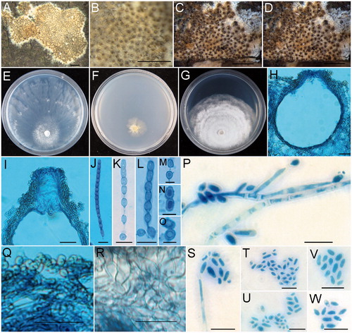 Figure 5. Trichoderma subiculoides (HMAS 254600). (A,B) Stroma on nature substrate; (C) Color of stroma after rehydration; (D) Color of rehydrated stroma in 3% KOH; (E−G) Cultures after 14 d at 25 °C (E: on CMD, F: on SNA, G: on PDA); (H) Perithecium in section; (I) Structure of perithecial at upper portion; (J) Ascus with ascospores; (K−O) Part-ascospores; (P) Phialides and conidia; (Q) Cortical and subcortical tissues in section; (R) Subperithecial tissue in section; (S−W) Conidia. Scale bars: A = 1 cm; B−D = 1 mm; H, I = 50 μm; J−P = 10 μm; Q, R = 20 μm; S−W = 10 μm.
