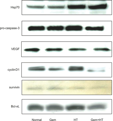 Figure 9. The expression levels of Hsp70, pro-caspase-3, VEGF, cyclin D1, and anti-apoptosis proteins. Cells were treated with heat 24 h before the treatment with gemcitabine (30 μM). Whole cell extracts were analyzed by western blotting. The results for no treatment (control) (lane 1), treatment with gemcitabine alone (30 μM) (lane 2), heat treatment alone (43°C, 1 h) (lane 3), and heat treatment combined with gemcitabine treatment (lane 4) are shown. Significant levels of Hsp70 were induced by heat treatment in MIAPaCa-2 cells. In contrast, gemcitabine treatment alone did not affect the protein levels of Hsp70. The levels of VEGF, pro-caspase-3, cyclin D1, and anti-apoptosis protein were decreased by heat treatment combined with gemcitabine treatment.