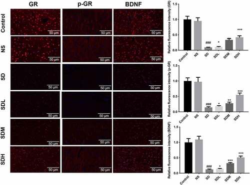 Figure 3. XYP reversed CUMS-suppressed expression of GR, p-GR, and BDNF. Immunofluorescence staining showed that CUMS caused significant down-regulation of GR, p-GR, and BDNF, which was abolished by XYP supplementation.