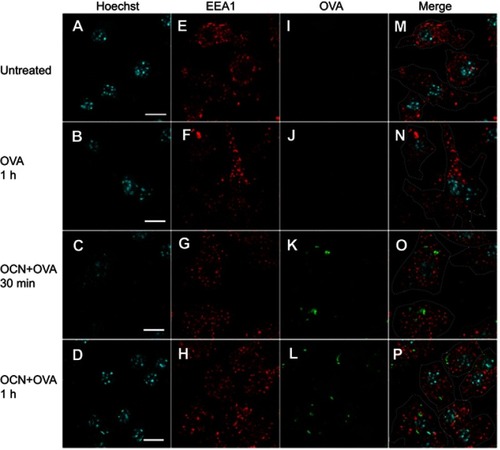 Figure 4 OVA delivered by OCNs did not colocalize with the endosomal compartment. OCN+OVA-fluorescein conjugate (ratio 3:1, green) were incubated with BMDMs. After 30 and 60 mins of incubation at 37°C, cells were subjected to immunofluorescence staining using rabbit monoclonal anti-EEA1 antibody and anti-rabbit IgG (H+L), F(ab’)2 fragment conjugated with Alexa Fluor® 555 for endosomes (red). Nuclei were stained with Hoechst (blue). Images were acquired by confocal microscopy. (A, E, I, M) Untreated cells, (B, F, J, N) cells incubated with OVA-fluorescein conjugate for 1 hr, (C, G, K, O) cells incubated with OCN+OVA-fluorescein conjugate for 30 mins, and (D, H, L, P) cells incubated with OCN+OVA-fluorescein conjugate for 1 hr. Scale bar =10 µm.