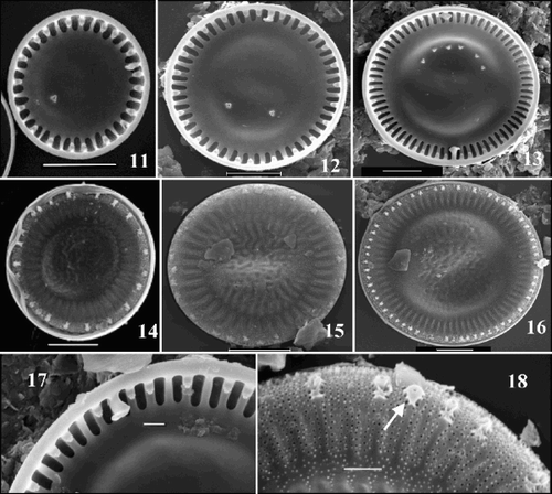Figs 11–18. SEM images of valves of the ‘ambiguous’ morph of Cyclotella scaldensis. Figs 11–13. Valve interiors. Figs 14–16. Valve exteriors over the size range. Fig. 17. Interior margin showing rimoportula. Fig. 18. Exterior margin showing process openings; RP opening is marked by an arrow. Scale bars represent 5 µm (Figs 11–16) and 1 µm (Figs 17, 18).