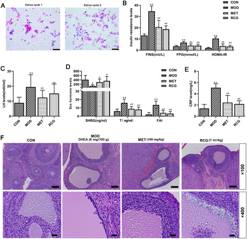 Figure 1. R. chingii treatment alleviated the disruption of serum hormone levels in the PCOS model. (A) Vaginal exfoliated smear in rats. Scale, 200 μm in the PCOS model group, the exudated vaginal cells showed continuous keratinization in two estrous cycles (10 d). (B-E) Fasting plasma glucose (FGP) was measured by Biochemical Analyzer. Serum fasting insulin (FINS), luteinizing hormone (LH), testosterone (T), C-reactive protein (CRP), and sex hormone binding globulin (SHGB) levels were detected by ELISA. Homeostasis model assessment of insulin resistance (HOMA-IR) = FPG × FINS/22.5, free androgen index (FAI) = T/SHBG × 100. (F) Morphological changes of ovary tissue (H&E, × 100 and × 400). *p < 0.05 vs. control, **p < 0.01 vs. control, ##p < 0.01 vs. PCOS.