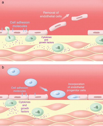 Figure 6 Chronic oxidative stress causes senescence of endothelial cells. This is characterized by a detachment of endothelial cells or part of the endothelial cell membrane(microparticles; A). B: With the persistence of oxidative stress, the capacity of neighboring endothelial cells to repair endothelial injury is limited, and vascular integrity becomes dependent on the incorporation of endothelial progenitor cells (EPCs) (adapted from Citation87).