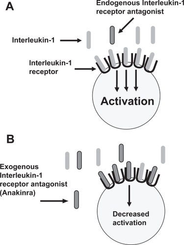 Figure 2 Mechanism of action of anakinra. IL-1 binds to its receptor, inducing cellular activation and inflammation (A) Exogenous IL-1 receptor antagonist (IL-1Ra; Anakinra) competes with IL-1 for binding to its receptor but does not induce cellular activation and inflammation (B).