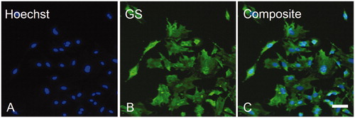 Figure 4. Expression of GS by isolated SGCs in culture. In order to confirm the establishment of SGC-enriched cultures, an anti-GS antibody (B) was employed, showing that virtually all cells were GS positive (C). Magnification = 100× (A–C). Scale bar = 50 µm. GS, Glutamine synthetase; SGCs, satellite glial cells.