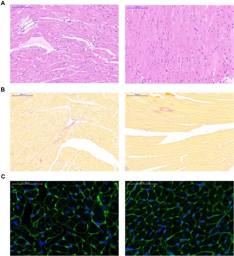 Figure 3 BHB protected from cardiac remodeling in vivo. (A) The HE staining was performed for the structure alternations. (B) Cardiac fibrosis was evaluated using Masson staining. (C) Cell size was showed using WGA staining.