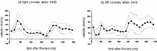 Figure 1. Mean (+/− SD) velocity curves in right (a) and left (b) coronary arteries measured with the FB_SP sequence.