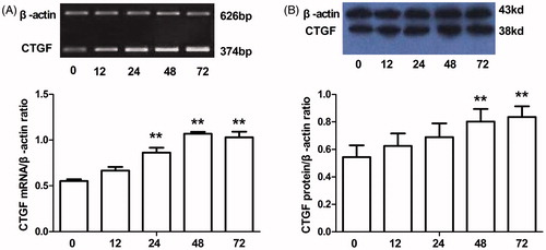 Figure 2. The time-dependent effect of high glucose on CTGF expression in HKCs. (A) The expression levels of CTGF mRNA in HKCs induced by 30 mm glucose for different periods of time (0, 12, 24, 48 and 72 h); (B) The expression levels of CTGF protein in HKCs induced by 30 mm glucose for different periods of time (0, 12, 24, 48 and 72 h); Gene and protein expression were detected by RT-PCR and Western blotting, respectively; β-actin was used as an internal control; **p < 0.01 versus 0 h.