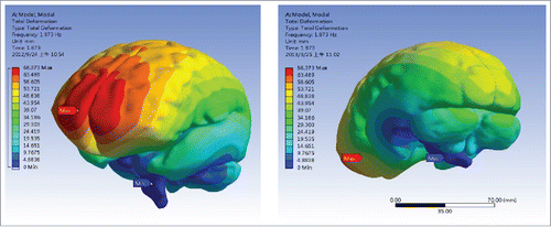 Figure 9. The second mode shape of a complex brain model: a swing type of vibration in right and left direction.