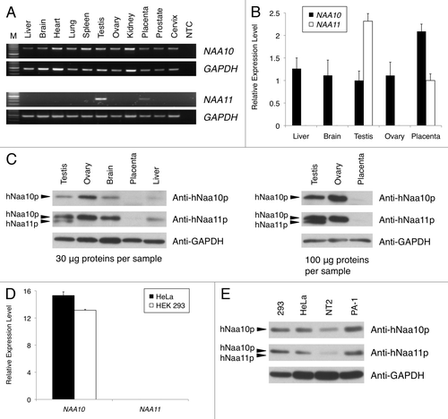 Figure 1 Expression analysis of NAA10 (NM_003491) and NAA11 (NM_032693) gene products in human tissues and cell lines. (A) Expression pattern of NAA10 and NAA11 transcripts in normal human tissues by RT-PCR. Expression of GAPDH was analyzed as an endogenous control. M: DNA molecular weight ladder. NTC: no-template control reaction. Sizes of amplicons: NAA10 (708 bp), NAA11 (382 bp) and GAPDH (452 bp). (B) Q-PCR analysis of NAA10 and NAA11 expression in selected human tissues. Relative expression levels of NAA10 (black bars) and NAA11 (white bars) after normalizing to that of 18S rRNA were presented using the 2(-Delta Delta C(T)) method. (C) Expression analysis of hNaa10p and hNaa11p in human tissues by western blotting. The detection of GAPDH protein was performed as an endogenous control. The amount of tissue lysates used is listed. The immuno-reactive band corresponding to hNaa11p appears at a slightly smaller molecular weight than that of hNaa10p; and the anti-hNaa11p antibody was cross-reactive to hNaa10p. (D) Q-PCR analysis of NAA10 and NAA11 expression in HeLa and HEK 293 cells. Relative expression levels of NAA10 and NAA11 after normalizing to that of 18S rRNA were presented using the delta C(T) method. NAA10 expression was detected in HeLa cells (black bar) and HEK 293 cells (white bar), whereas no NAA11 expression was detected. Data shown were averaged from triplicate measurements of duplicate preparations of total RNA samples from each cell line. (E) Expression analysis of hNaa10p and hNaa11p in human cell lines by western blotting. Thirty micrograms of total protein lysates were loaded per sample. No immuno-reactivity corresponding to hNaa11p was observed in any of the cell lysates. The detection of GAPDH protein was performed as an endogenous control. In figures (B and D), error bars represent the standard deviations of relative gene expression levels.