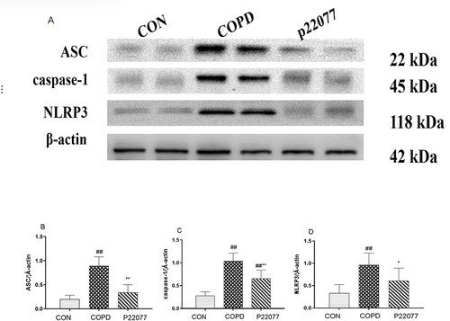Figure 5 P22077 affects ASC, caspase-1 and NLRP3 expression in the LPS and smoke induced COPD rats model. (A). ASC, caspase-1 and NLRP3 protein expression representative Western blot images. (B–D). Relative ratios of ASC, caspase-1 and NLRP3 to β-actin, respectively. Data expressed as mean ± SEM (n = 7/group). ##P < 0.01 vs control group; *P < 0.05, **P < 0.01 vs COPD.