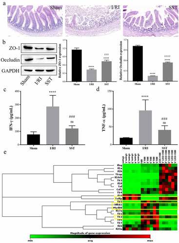 Figure 1. SST alleviated intestinal epithelial barrier injury induced by I/R and regulated the expression of inflammation-related genes. (a) Representative images of rat intestinal tissues stained with H&E. Bars ‘ – ’ indicate 50 μm. (b) The expression of the TJ proteins ZO-1 and Occludin in intestinal tissues detected by Western blotting. (c-d) Expression levels of the inflammatory factors IFN-γ and TNF-α in serum. (e) Heatmap of the differential expression of some inflammation-related genes detected by PCR array. The yellow square frames show inflammation-related Tollip/TLR2/MyD8/NF-κB gene expression changes. Sham, control group; I/RI (IIRI), ischemia–reperfusion injury group; SST (IIRI+SST), I/RI rats pretreated with SST. (a-d), n = 4 per group; (E), n = 6 per group. One‑way ANOVA followed by Bonferroni post hoc test was used to compare the differences among different groups, ‘ns’ indicated no significance. nsP>0.05, ****P < 0.0001 vs. sham group; ###P < 0.001, ####P < 0.0001 vs. I/RI group.