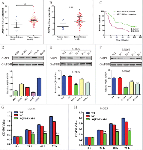 Figure 1. Upregulated AQP1 expression correlated with poor osteosarcoma patient survival and knockdown of AQP1 suppressed the proliferation of osteosarcoma cells. (A) AQP1 expression was significantly increased in osteosarcoma tissues when compared with the adjacent tissues of patients from GEO dataset GSE42352 (*P < 0.05). (B) AQP1 mRNA level was significantly higher in osteosarcoma tissues (n = 64) than that in bone cysts (n = 14) from patients admitted to Shanghai tenth People's Hospital between 2009 and 2012. (C) the overall survival time of 64 patients with osteosarcoma. (D) AQP1 expression level in 5 osteosarcoma cell lines was analyzed by Western blot (upper panel) and real-time PCR (lower panel). Data were based on at least 3 independent experiments. (E, F) Expression of AQP1 in U2OS and MG63 cells was analyzed by Western blot (upper panel) and real-time PCR (lower panel). WT: wild type cells; NC: scrambled shRNA virus infected cells; Ri-1, Ri-2 and Ri-3: AQP1-shRNA-1, −2 and −3 virus infected cells. (G, H) Cell proliferation was detected 0, 24, 48 and 72 hours after viral infection in U2OS and MG63 cells. WT: wild type cells; NC: scrambled shRNA virus infected cells; AQP1-Ri-1: AQP1-shRNA-1 virus infected cells. Data were based on at least 3 independent experiments, and shown as mean ± SD (**P < 0.01 as compared with NC).