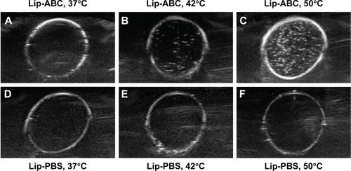 Figure 2 Ultrasound imaging of Lip-ABC or Lip-PBS under different temperature.Notes: (A–C) Ultrasound imaging of Lip-ABC at 37°C, 42°C, and 50°C. (D–F) Ultrasound imaging of Lip-PBS at 37°C, 42°C, and 50°C.Abbreviations: Lip-ABC, liposomes containing ammonium bicarbonate; Lip-PBS, liposomes containing phosphate-buffered saline.