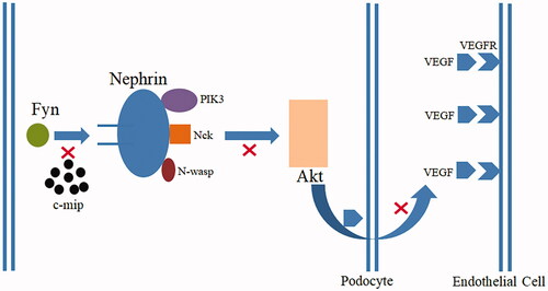 Figure 3. The high expression of c-mip in podocytes blocks the Fyn-Nephrin protein signaling pathway, preventing Nephrin from recruiting PIK3, NcK, and N-wasp. Nephrin is unable to phosphorylate and activate Akt, and podocytes cannot participate in normal filtration barrier and secretion of vascular endothelial growth factor (VEGF).