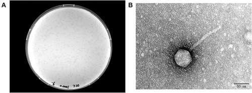 Figure 1 (A) Morphology of IME268 plaques. Phages were plated in LB agar and overlaid with a liquid culture of K. pneumoniae 1733. The plates were incubated at 37°C. Clear, well-defined IME268 plaques were observed and photographed. (B) The morphology of phage IME268. IME268 was negatively stained with 2% phosphotungstic acid (PTA) and examined by transmission electron microscopy (TEM) at an accelerating voltage of 80 kV. The scale bar represents 50 nm.