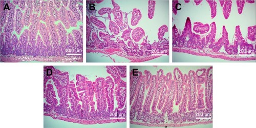 Figure 8 Representative images of small intestines. (A) The sham group and effect of pretreatment with (B) blank suspension, (C) andrographolide suspension, (D) blank nanoemulsion, and (E) the optimized andrographolide-loaded nanoemulsion by oral administration 1 h before treatment with indomethacin on histological appearance of indomethacin-induced small intestine lesions in mice (original magnification ×200).