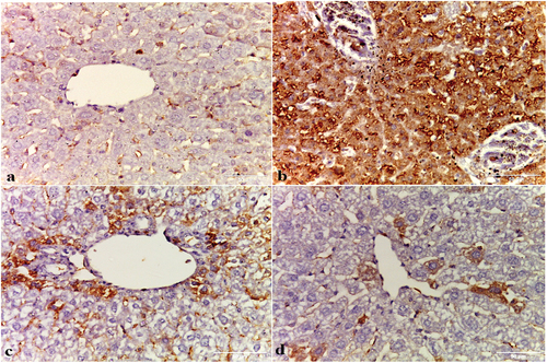 Figure 11. Photomicrographs showing P53 immuno-expression in (a) negative control, (b) HCC control group, (c) HCC+IQ [10 mg/kg bw] -treated group, and (d) HCC+ IQ [20 mg/kg bw]-treated group. Negative control (a) and HCC+IQ-treated groups (c, d) show barely detectable P53 in the hepatocytes nuclei, in comparison with the dense expression in HCC control group (b).