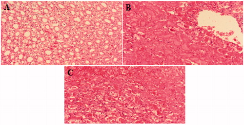 Figure 1. Microscopic images of (A) control kidney, (B) non-ischemic right kidney, (C) ischemic left kidney (hematoxylin–eosin (H&E) 100×).