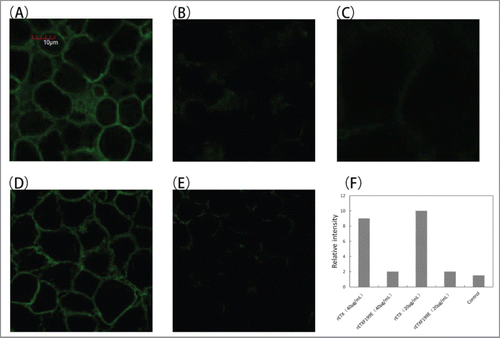 Figure 4. Binding of toxins on the surface of MDCK cells. Confocal microscopy assay was performed as described in experimental procedures to test the binding proteins. (A) Cells were treated with rETX(20 μg/ml), (B) cells were treated with rETXF199E(20 μg/ml), (C) cells were treated with PBS, (D) cells were treated with rETX(40 μg/ml), (E) cells were treated with rETXF199E(40 μg/ml), (F) Relative fluorescent intensity of photos of the 5 groups. Cells were fixed and stained with anti-His monoclonal antibody and goat anti-mouse IgG (H + L).