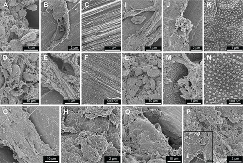 Figure 6 SEM analysis of retrieved implants.Notes: The SEM survey micrographs show the Ma (A–H) and Nano (I–P) implants after 3 days (upper panel), 6 days (middle panel), and 28 days (bottom panel) of implantation. At 3 days, the retrieved implants appeared partially covered with fibrinous material, which was entrapped with numerous erythrocytes and leukocytes (B for Ma and I for Nano implants). The higher magnification at this time point shows cells extending filopodia on the surfaces (A for Ma and J for Nano implants), which, in many occasions, appeared to interact with nanostructures (J). (C) and (K) show exposed areas of the implants, where the Ma (C) and Nano (K) surfaces can be observed. After 6 days, the relative proportion of the cellular material adherent to either implant type has increased (D for Ma and L for Nano implants). Yet, at this time point, some areas are exposed which reveal the underlying Ma (E) and Nano (M) implant surfaces. The higher magnifications of the Ma (F) and Nano (N) surfaces show a relative increase in the adsorbed protein layer, but still the characteristic morphology of the Ma and Nano surfaces can be observed. After 28 days, the adherent material was bone-like tissue observed at several locations of the retrieved Ma (G, H) and Nano (O, P) implants. At some locations where the implant was denuded from the adherent tissue, the Nano implant surface can be observed (insert in P).Abbreviations: SEM, scanning electron microscopy; Ma, machined; Nano, nanopatterned.