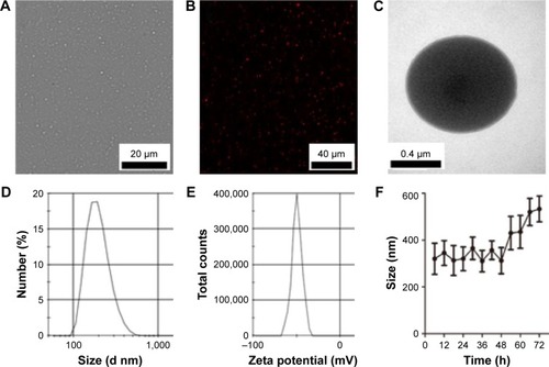 Figure 2 Characterization of nanodroplets.Notes: (A) Optical microscopy image of FA-NDs. (B) CLSM image of DiI-stained FA-NDs. (C) TEM image of FA-NDs. (D and E) Size distributions and zeta potential of FA-NDs. (F) Size distribution of FA-NDs at 4°C after long-term storage (n=3).Abbreviations: FA-ND, folate-targeted perfluoropentane nanodroplet; CLSM, confocal laser scanning microscopy; TEM, transmission electron microscope; DiI, 1,1′-dioctadecyl-3,3,3′,3′-tetramethylindocarbocyanine perchlorate.