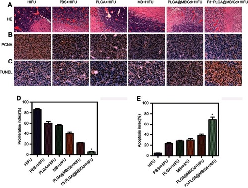 Figure 7 (A) H&E staining (magnification, 100×), (B) PCNA staining (magnification, 400×) and (C) TUNEL staining (magnification, 400×) of MDA-MB-231 tumor tissues in various groups after HIFU ablation. (D) proliferative index and (E) apoptosis index in various groups. (*P<0.05).Abbreviations: H&E, hematoxylin-eosin; PCNA, proliferating cell nuclear antigen; TUNEL, terminal deoxynucleotidyl transferase-mediated dUTP nick end labeling.