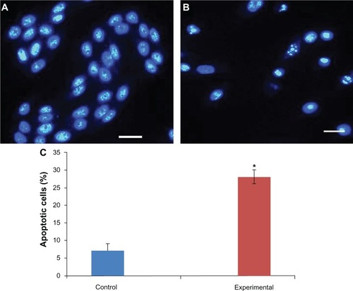 Figure 2 Effect of triptolide on chromatin condensation.