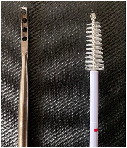 Figure 1. Endocervical brush (left) and Kevorkian curette (right) (Figure 1).