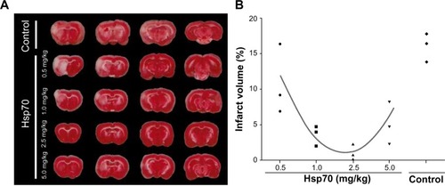 Figure 3 Detection of brain infarction in triphenyl tetrazolium chloride (TTC)-labeled tissue sections.