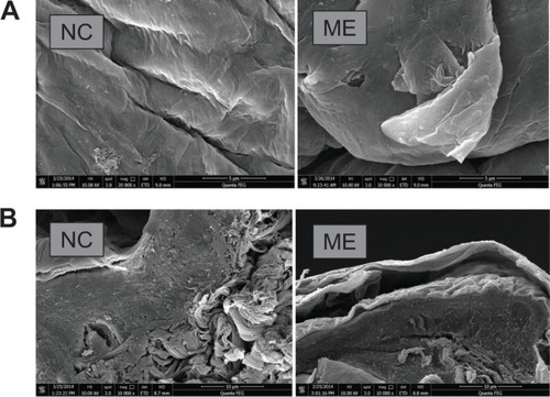 Figure 10 Microstructures of nude mouse skin (normal control [NC] and treated with microemulsion [ME]) obtained from scanning electron microscopy. (A) Skin surface ×20,000; (B) skin vertical section ×10,000.