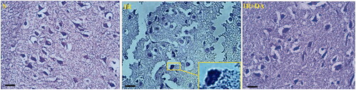 Figure 5. The photomicrographs illustrating the Cresyl violet-stained coronal sections from right hemispheres of sham (S), control ischaemic (IR) and Dorema aucheri-treated ischaemic (IR + DA) groups. The enlarged rectangle at a stained section of the control IR group at higher magnification (1000×) indicates apoptotic bodies and pyknotic nuclei with shrunken appearance (Scale bar = 20 µm, 400×).