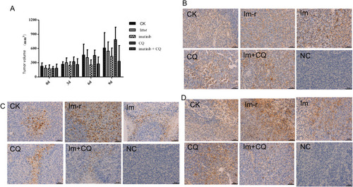 Figure 2 (A) Effect on tumor volume. (B) The immunohistochemical detection of Beclin 1 protein expression in rat tumor tissue. (C) The immunohistochemical detection of caspase 3 protein expression in rat tumor tissue. (D) immunohistochemical detection of caspase 7 protein expression in rat tumor tissue.Abbreviations: CK, normal control group; im-r, imatinib-resistant group; im, imatinib-resistant cells + imatinib; CQ, imatinib-resistant cells + chloroquine; im+ CQ, imatinib-resistant cells + imatinib + chloroquine.