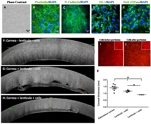 Figure 6. Functional characterization of hCE cells cultured on lenticules.