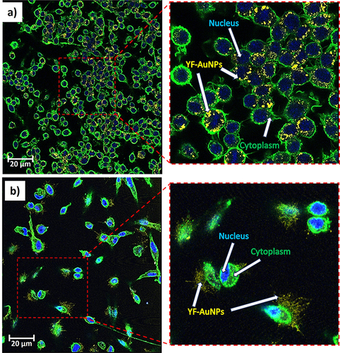 Figure 9 Confocal microscopy images of YF-AuNPs (50 μg/mL): cellular internalization in (a) RAW 264.7 and (b) HAEC cells after 24 hr incubation. The cytoplasm (green – WGA labeling), nucleus (blue – DAPI stain) and YF-AuNPs (yellow) seen.