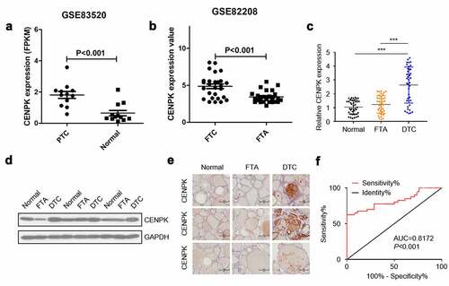 Figure 1. CENPK is upregulated in DTC tissues