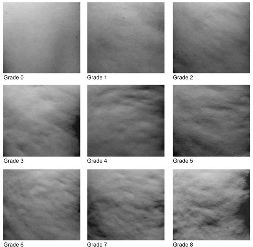 Figure 3 Visual grading scale for orange-peel appearance. The scale goes from 0 “no intensity” to 8 “maximum intensity.”