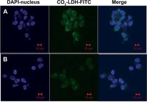 Figure 10 Confocal microscopic images of intracellular localization in NSC 34 cells.Notes: (A) 6.25 mg·mL−1 CO3 layered double hydroxide (LDH)–fluorescein isothiocyanate (FITC), incubated for 2.5 hours; (B) free 6.25 mg·mL−1 FITC anions incubated for 4 hours. Reproduced from Li SD, Li JH, Wang CL, et al. Cellular uptake and gene delivery using layered double hydroxide nanoparticles. J Mater Chem B. 2013:61–68, with permission of The Royal Society of Chemistry.Citation162