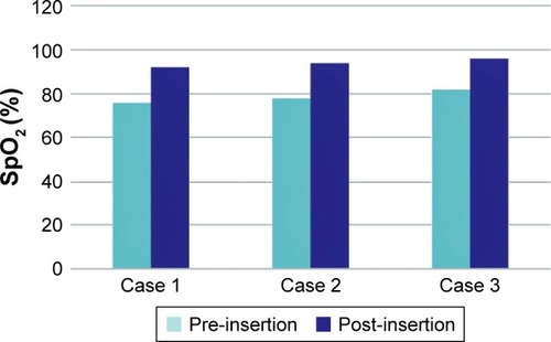Figure 4 Improvement of oxygen saturation value (pre-insertion and post-insertion).