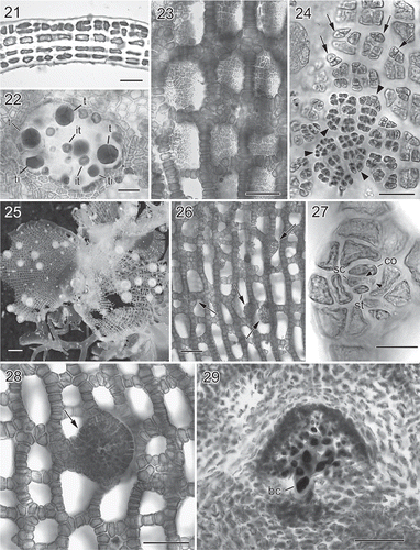 Figs 5. Martensia kentingii W.-C. Yang & S.-M. Lin sp. nov. Vegetative and reproductive morphology (Hou Wan, Kenting National Park). 21. Cross-section through basal part of membranous blade. Scale bar = 50 μm. 22. Close up of a tetrasporangial sorus showing multinucleate tetrasporangial initials (ti), immature tetrasporangia (it) and tetrahedrally divided tetrasporangia (t). Scale bar = 50 μm. 23. Spermatangial sori borne on longitudinal lamellae. Scale bar = 100 μm. 24. Close up of a developing spermatangial sorus showing spermatangial parental cell initials (arrows) and spermatangial parental cells (arrowheads). Scale bar = 25 μm. 25. Close up of cystocarps borne on network. Scale bar = 1 mm. 26. Middle portion of network showing procarp-bearing lobes (arrows) derived from margins of longitudinal lamellae. Scale bar = 100 μm. 27. Close up of a procarp composed of a supporting cell (sc), the one-celled sterile lateral (st), a carpogonial branch (arrowheads) and a cover cell (co). Scale bar = 25 μm. 28. Surface view of a young cystocarp with an ostiole (arrow). Scale bar = 100 μm. 29. Cross-section through a immature carposporophyte showing enlarged nuclei and newly formed basal cell (bc). Scale bar = 100 μm.