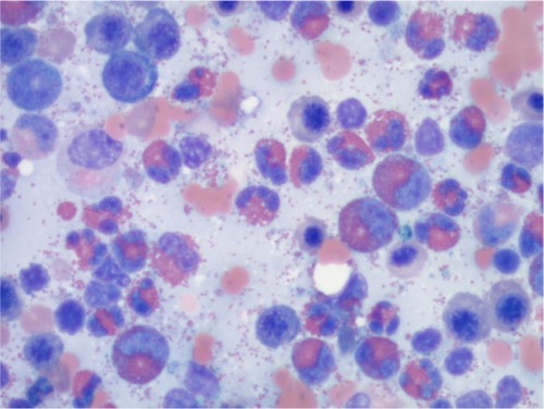 Figure 1 Examination of peripheral blood smear.