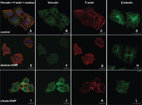 Figure 5 HUVECs were stained for F-actin (red), vinculin (green), nucleus (blue) and β-tubulin (green) with or without IONPs incubation, (×13000 magnification).Notes: (a–d) Untreated control cell; (e–h) One hour incubation with dextran-IONP at 0.1 mM; (i–l) One hour incubation with citrate-IONP at 0.1 mM.Abbreviations: HUVECs, human umbilical vein endothelial cells; IONP, iron oxide nanoparticles.