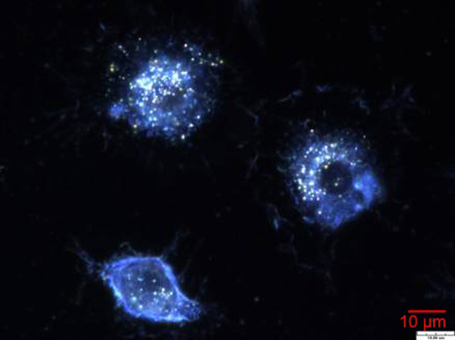 Figure S3 Dark-field image of cells after treated with AuNPs and laser irradiation of 100 mW/cm2.Abbreviation: AuNP, gold nanoparticle.